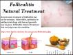 Natural Treatment for Folliculitis