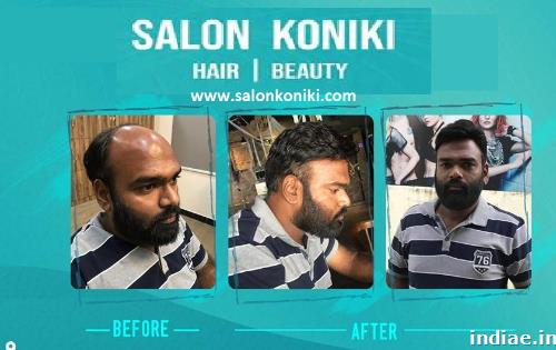 Hair styling & Permanent hair patch treatment in hyderabad - Saloon koniki