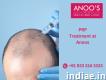 Advanced Prp Treatment for Hair Regrowth at Anoos